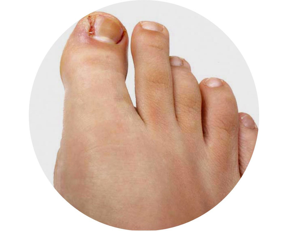 Image of arthritic joint
