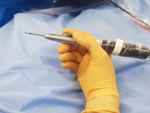 An example of the small drill used in minimally invasive foot surgery