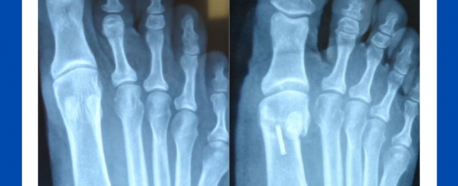 Remember functional anatomy and to x-ray Remember functional anatomy and to x-ray