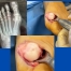 photos by Sydney Foot and Ankle Surgeon Damien Lafferty