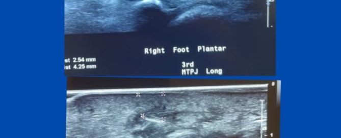 Ultrasound in the operating theatre Ultrasound in the operating theatre