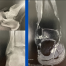 X-ray and MRI imagery showing a patient's ankle; images by Sydney Foot and Ankle Surgeon Damien Lafferty
