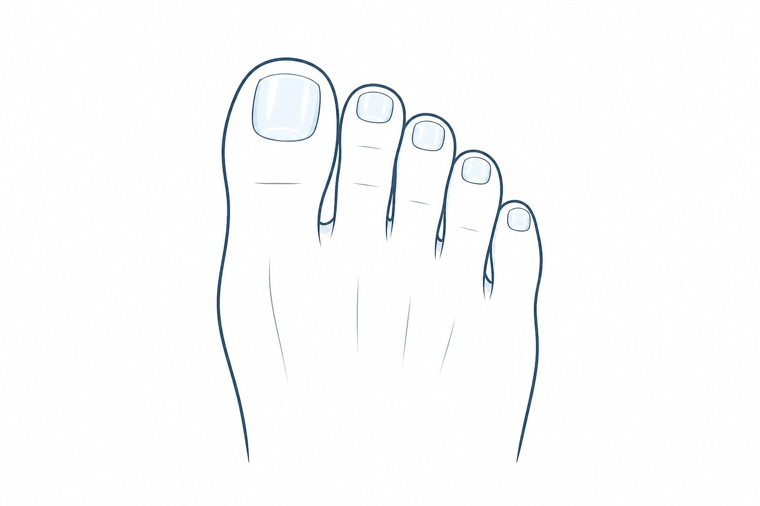The 4-Part Combination Protocol for Stubborn Fungal Nails: Why Monotherapy Often Fails